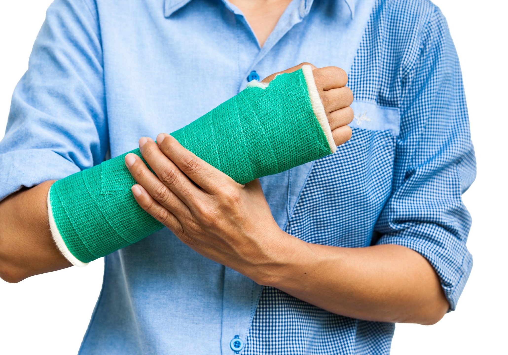 Green,Cast,On,An,Arm,Of,A,Women,Isolated,On